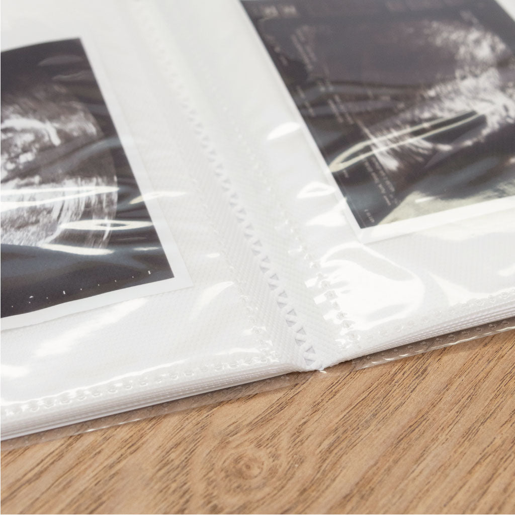 20 Fächer für Ultraschall Bilder