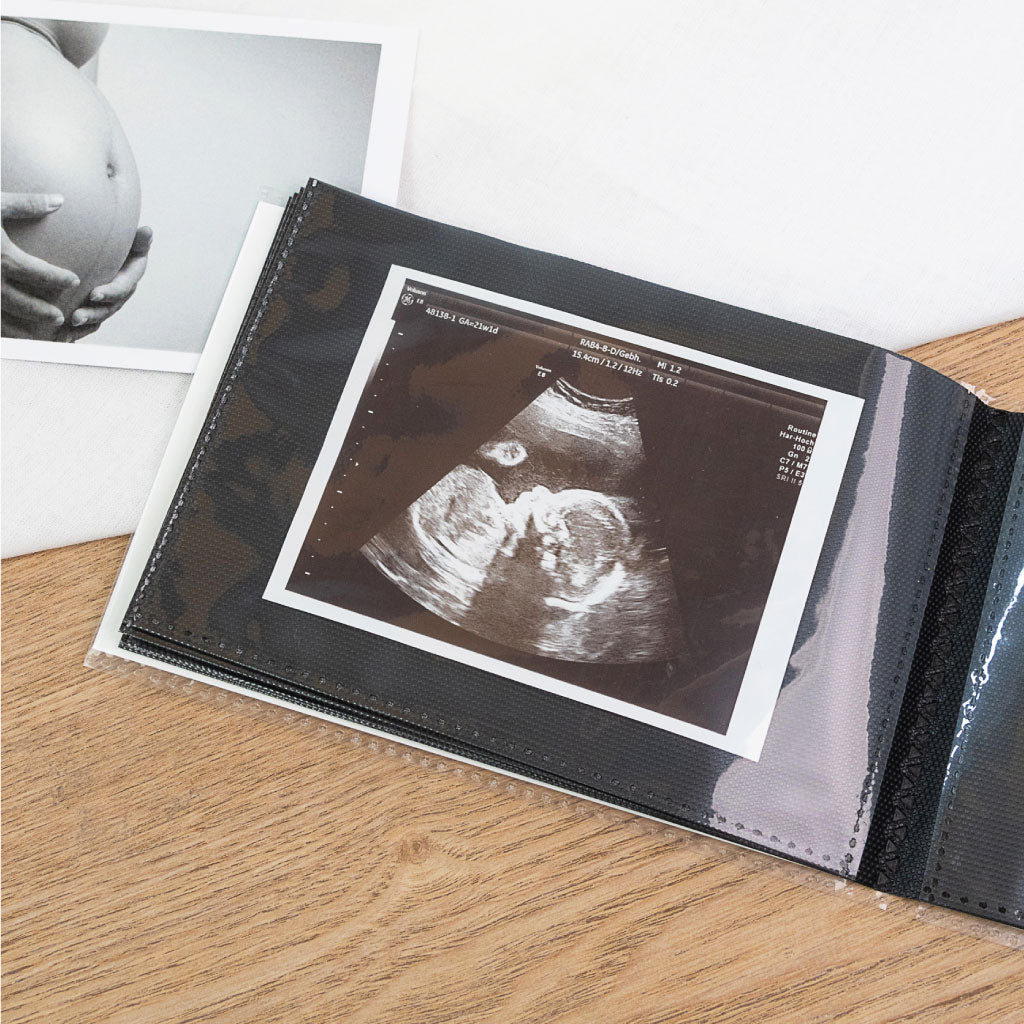 Detailansicht Ultraschallbilder Aufbewahrung: Ultraschallfoto im schwarzen Einsteckalbum, daneben Foto eines Babybauchs im Hintergrund.