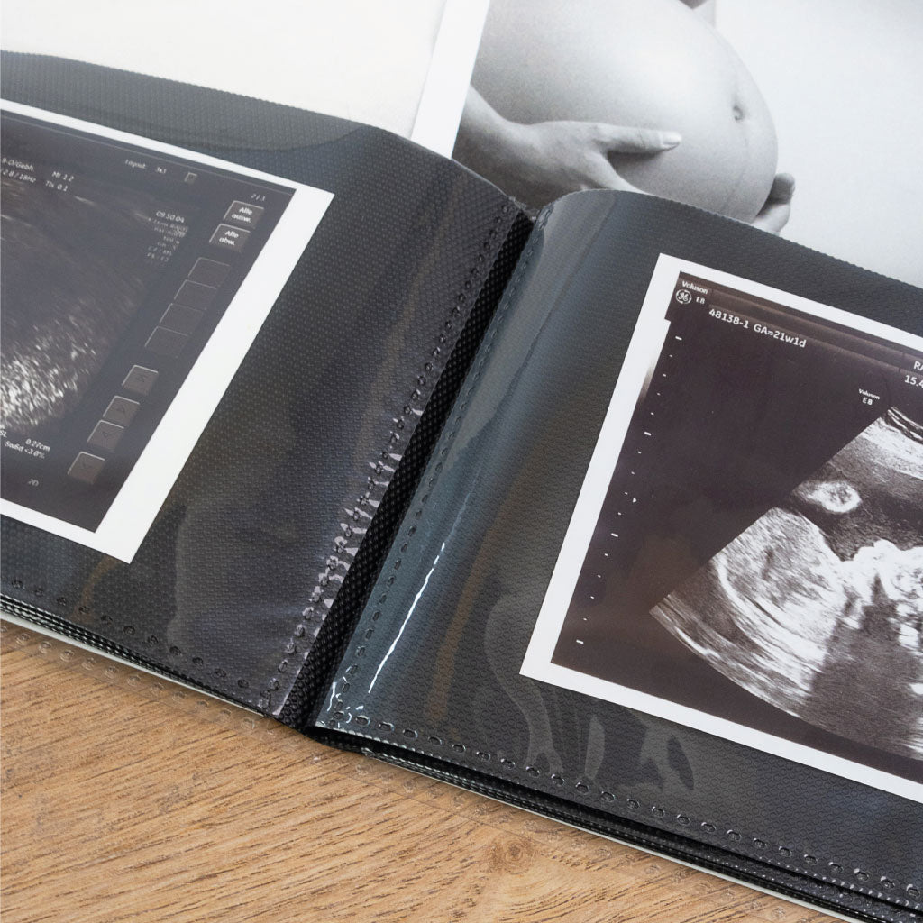 Schwarzes Einsteckalbum innen: offene Hülle mit eingesteckten Ultraschall Fotos, strukturierte schwarze Seiten als Schutz für Bilder.