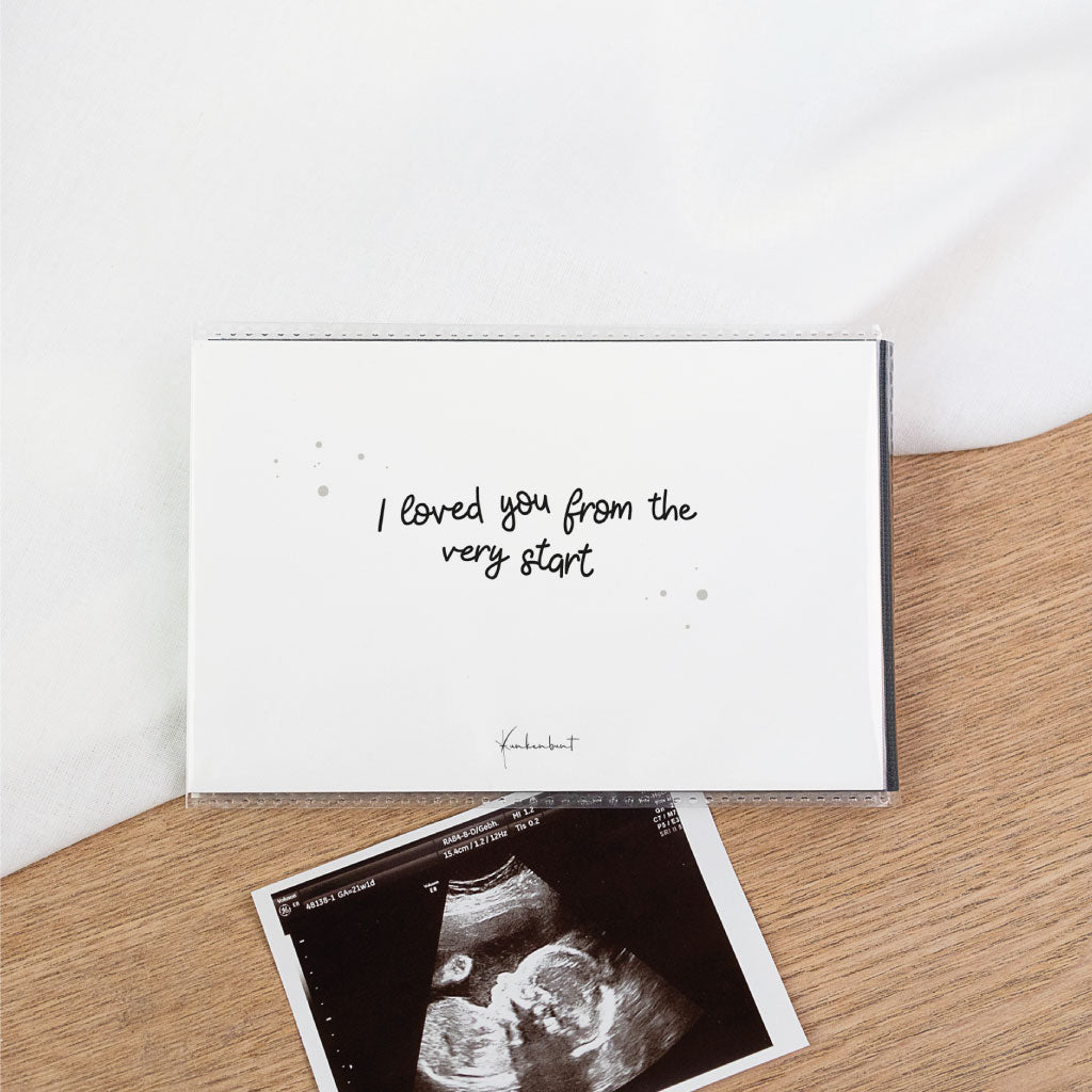 Ultraschallbilder Aufbewahrung Album: Rückseite „I loved you from the very start“ in schwarz weiß, darunter Ultraschallfoto – Schutz für Bilder im Einsteckalbum.