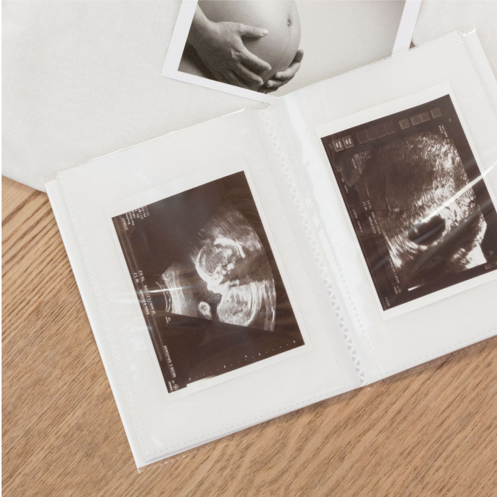 20 Fächer für Ultraschall Bilder