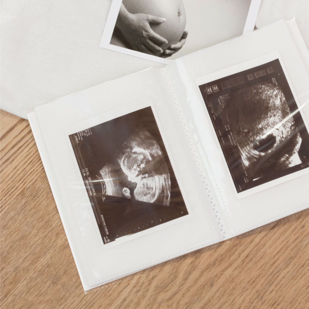 20 Fächer für Ultraschall Bilder