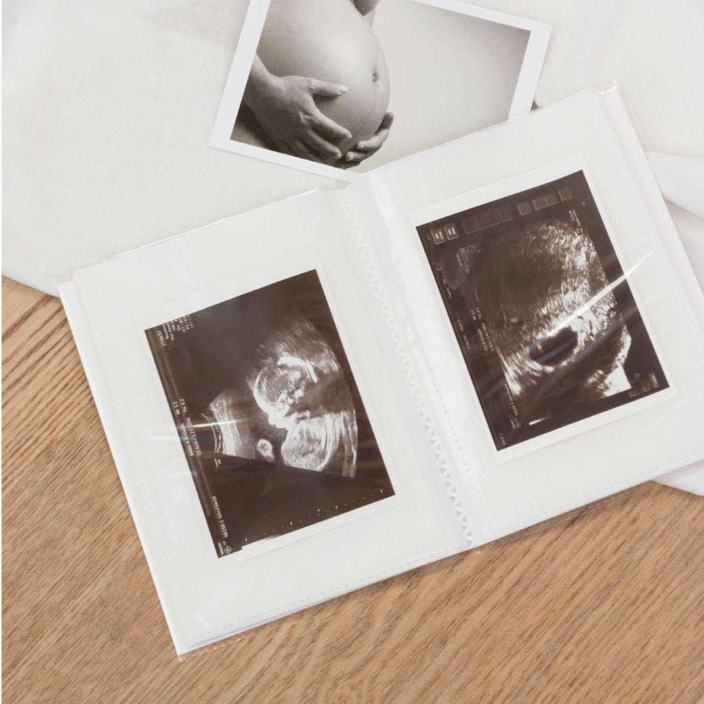 Einsteckalbum für Baby Ultraschall Fotos