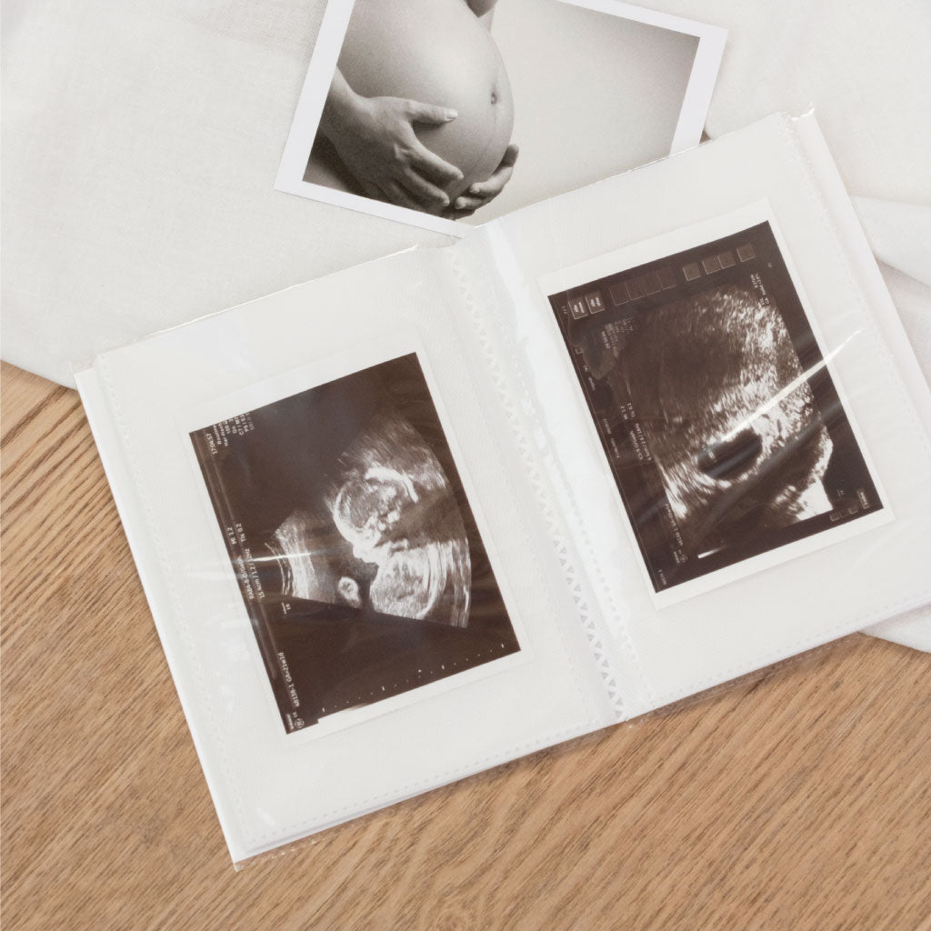 Einsteckalbum für Baby Ultraschall Fotos